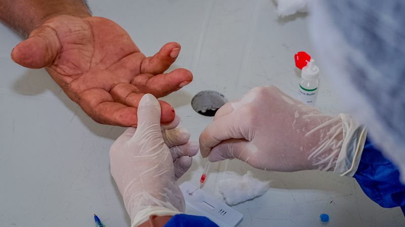 Objetivo da Prefeitura é monitorar casos de covid-19 em servidores e acompanhar tratamento 